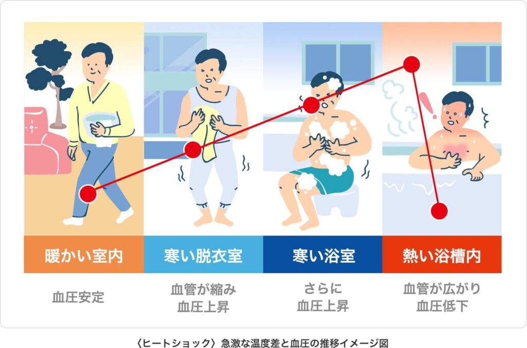 ヒートショックのリスク